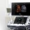 Samsung-Medison-RS80A-Ultrasound-Machine