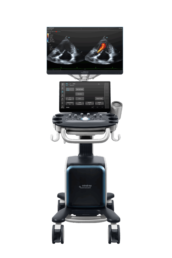 Mindray V80 Mindray V80