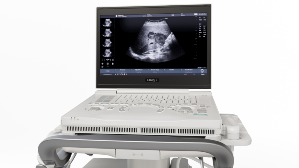 LOGIQ_e_TP_012-scaled LOGIQ_e_TP_012-scaled