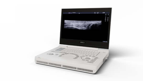 LOGIQ_e_TP_Hero_Trackpad_v5-1-1 LOGIQ_e_TP_Hero_Trackpad_v5-1-1